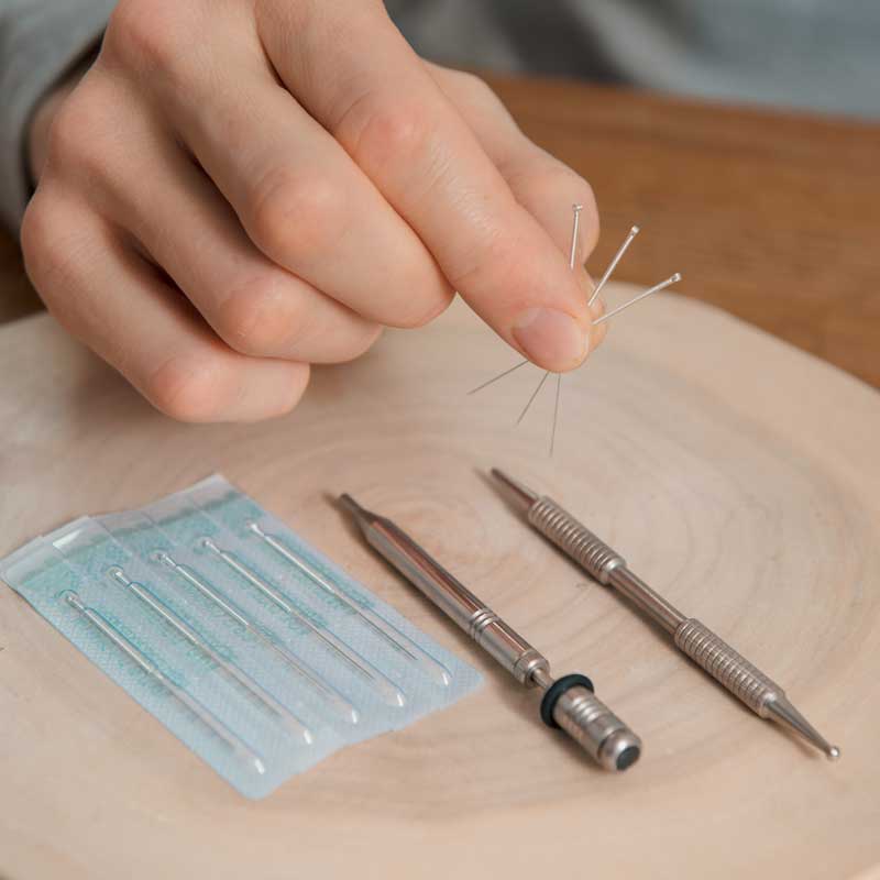 Akupunkturbehandlung in der HNO Praxis Preetz